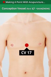 cv 17 acupiont